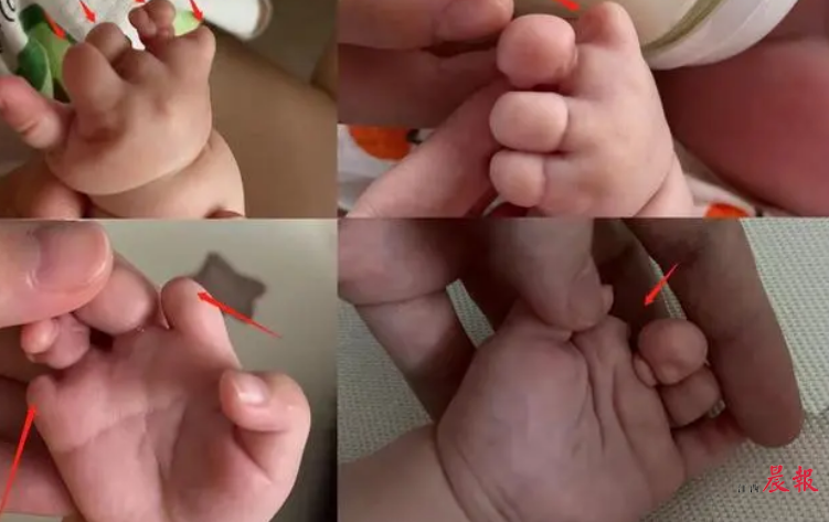 深圳卵子捐赠网络